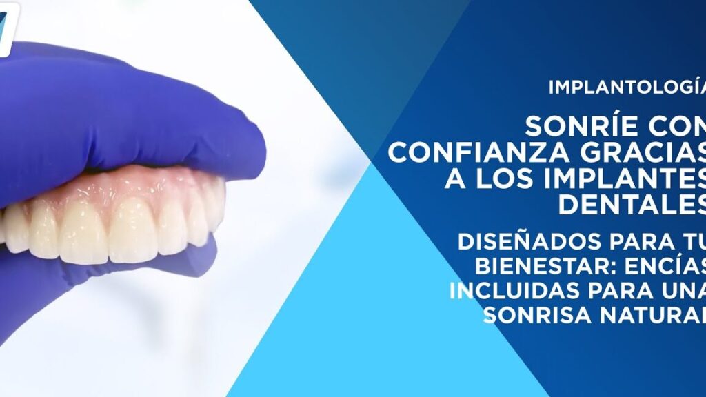 Descubre cómo los implantes dentales en México están revolucionando sonrisas: ¡La solución perfecta para recuperar tu confianza! descubre como los implantes dentales en mexico estan revolucionando sonrisas la solucion perfecta para recuperar tu confianza