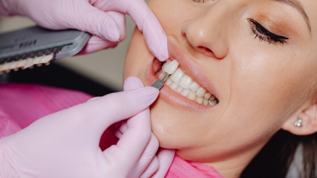 Descubre el secreto de las sonrisas perfectas en Guadalajara, México: la revolución en la odontología cosmética descubre el secreto de las sonrisas perfectas en guadalajara mexico la revolucion en la odontologia cosmetica