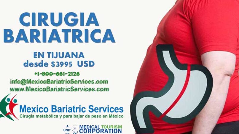 La manga gástrica en Matamoros, México: La solución efectiva para la pérdida de peso la manga gastrica en matamoros mexico la solucion efectiva para la perdida de peso