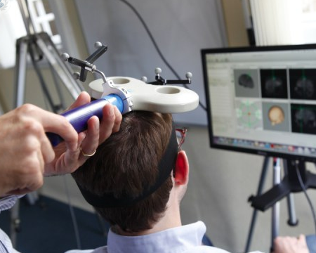 ¡Descubre el sorprendente poder de la estimulación magnética transcraneal en México y transforma tu vida! descubre el sorprendente poder de la estimulacion magnetica transcraneal en mexico y transforma tu vida