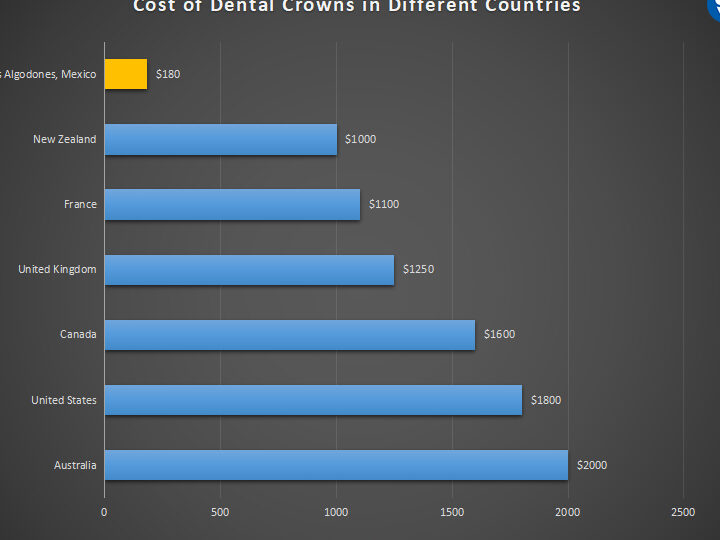 Todo lo que necesitas saber sobre las coronas dentales en Los Algodones, México: calidad y asequibilidad todo lo que necesitas saber sobre las coronas dentales en los algodones mexico calidad y asequibilidad